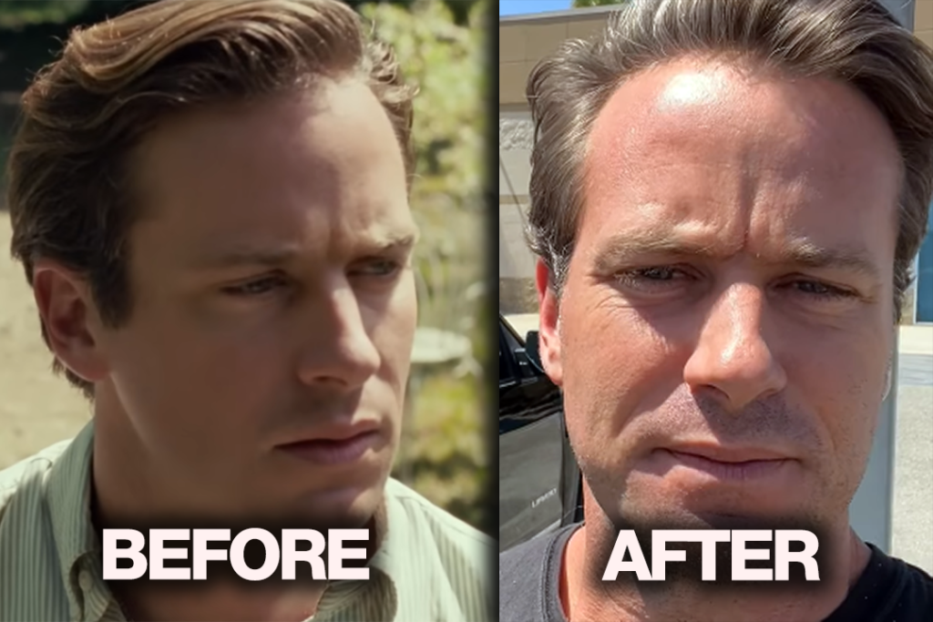 Armie Hammer Forced to Sell Beloved Truck Amid Financial Struggles and Career Downfall 3 Armie Hammer Forced to Sell Beloved Truck